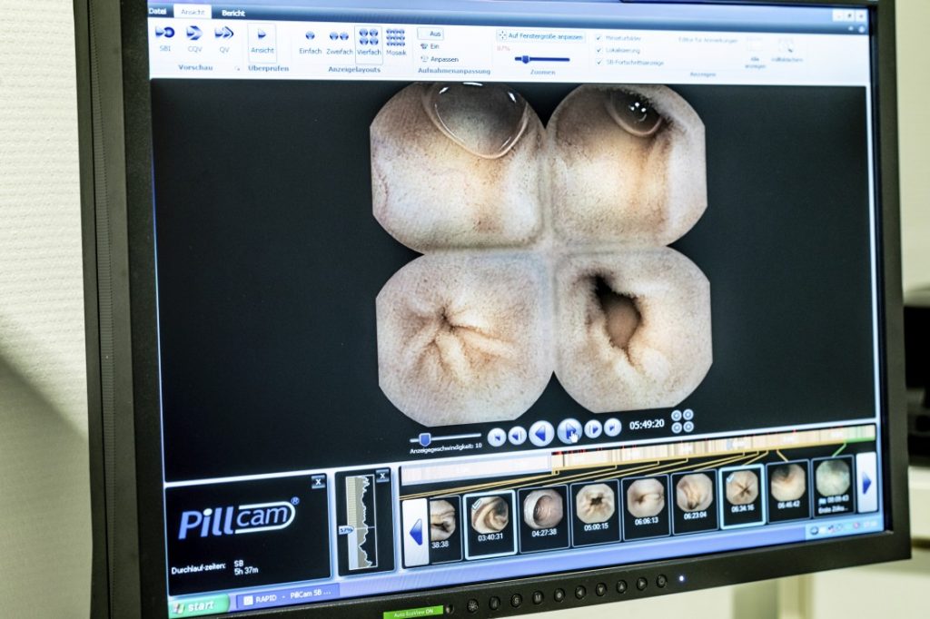 Kapselendoskopie